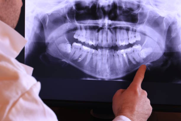 Best Walk-In Emergency Dentist in Chelsea, MI