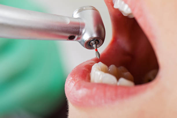 Best Emergency Dental Surgery in Chelsea, MI